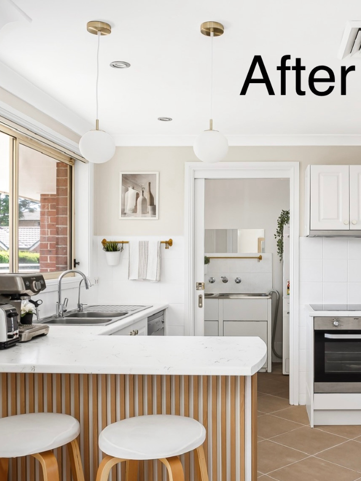 After Resurfacing